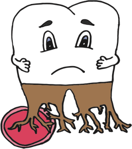 RootCanal